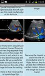 Captură de ecran Upper Abdominal Ultrasound apk 3