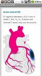 Critical Care ACLS Guide screenshot apk 