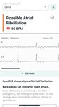 AliveECG - Heart Monitor capture d'écran apk 1