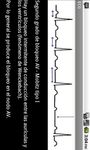 Imagen  de Electrocardiograma ECG Tipos