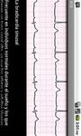 Imagen 1 de Electrocardiograma ECG Tipos