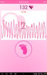 Gambar Fetal Doppler UnbornHeart 3