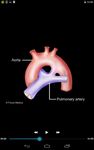 Captura de tela do apk Cardiology-Animated Dictionary 3