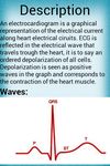 Electrocardiogram image 10