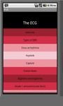 Immagine 4 di Electrocardiogram ECG Types