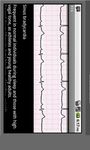 Immagine 3 di Electrocardiogram ECG Types