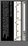 Immagine 2 di Electrocardiogram ECG Types