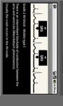 Immagine  di Electrocardiogram ECG Types