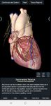 Screenshot 13 di Essential Anatomy 3 apk