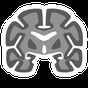 Icona Atlas of MRI Brain Anatomy