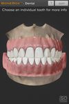 BoneBox™ - Dental Lite ekran görüntüsü APK 2