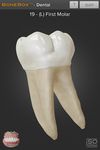 BoneBox™ - Dental Lite στιγμιότυπο apk 1