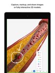 Screenshot 8 di BioDigital Human - 3D Anatomy apk