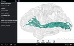 Скриншот 2 APK-версии Brain Tutor 3D
