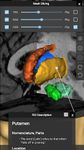 Скриншот 20 APK-версии Brain Tutor 3D
