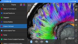 Скриншот 18 APK-версии Brain Tutor 3D