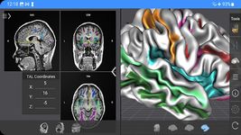 Скриншот 16 APK-версии Brain Tutor 3D