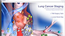 Imagine Lung Cancer Staging Table 4