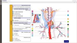 Imagine Lung Cancer Staging Table 1