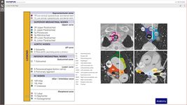 Imagine Lung Cancer Staging Table 