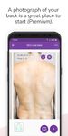 Captură de ecran Miiskin - Melanoma Skin Cancer apk 1