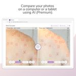 Captură de ecran Miiskin - Melanoma Skin Cancer apk 