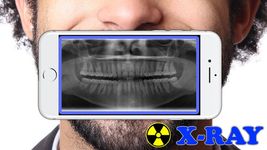 Gambar X-Ray Tubuh Scanner Prank 6