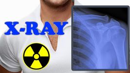 Gambar X-Ray Tubuh Scanner Prank 5