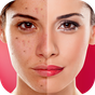 Face Blemishes Cleaner & Photo Scars Remover APK