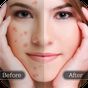 Face Blemish Remover - Smooth Skin & Beautify Face icon