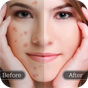 Face Blemish Remover - Smooth Skin & Beautify Face icon
