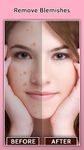 Face Blemish Remover - Smooth Skin & Beautify Face screenshot apk 17