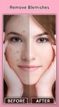 Face Blemish Remover - Smooth Skin & Beautify Face screenshot apk 10