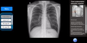 Radiographic Anatomy X-Ray 이미지 6