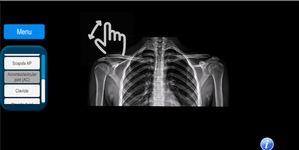 Radiographic Anatomy X-Ray 이미지 2