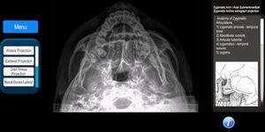 Radiographic Anatomy X-Ray 이미지 