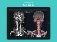 Скриншот 1 APK-версии Complete Anatomy for Android