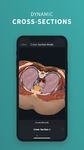 Tangkapan layar apk Complete Anatomy for Android 17